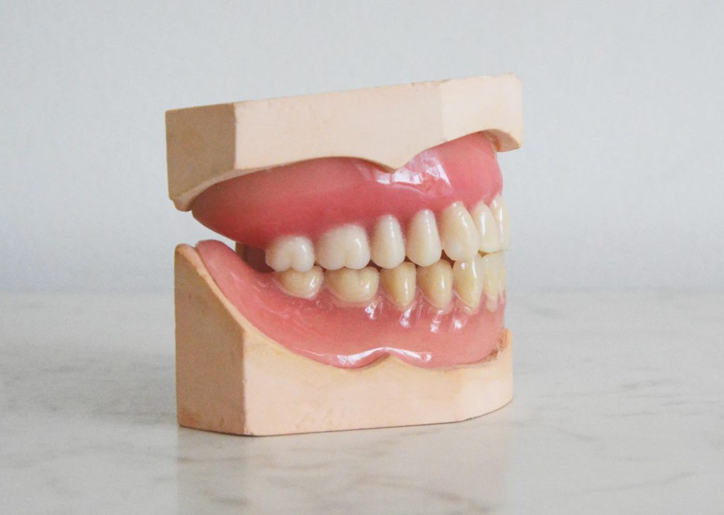 치아